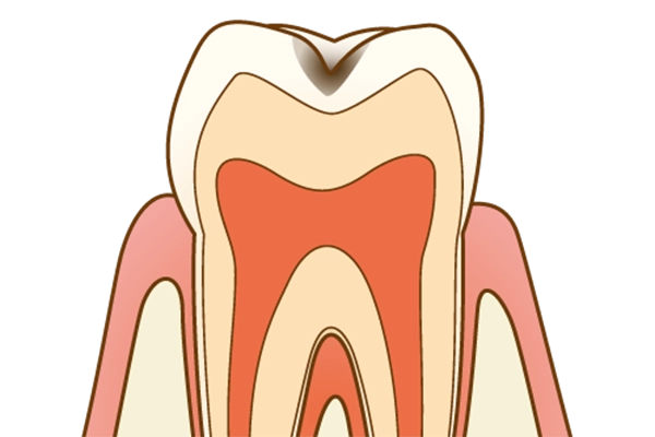 C1