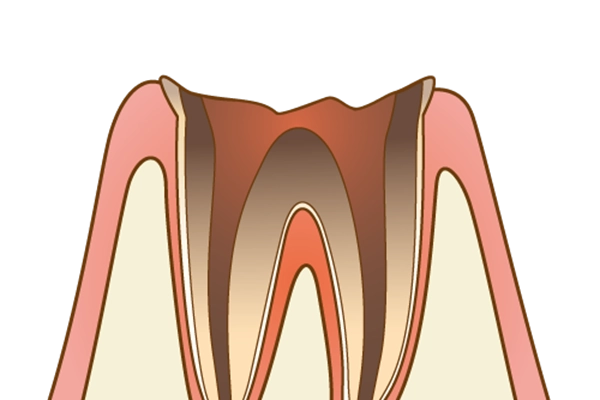 C4