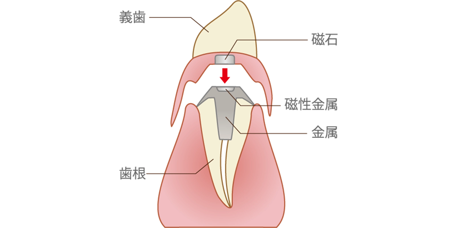 マグネット